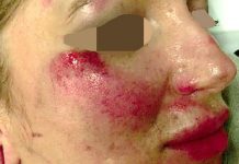 Frau in Wien verprügelt