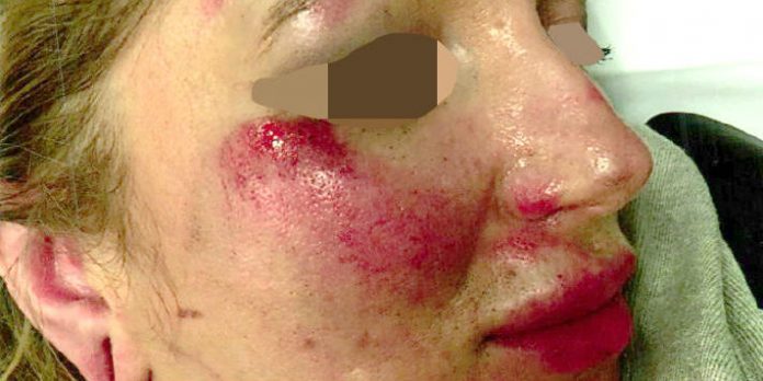 Frau in Wien verprügelt